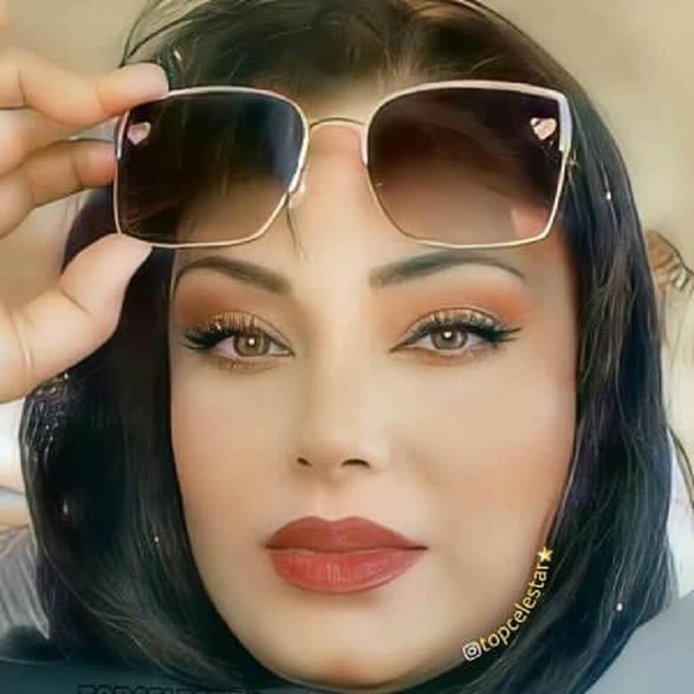 صبا راد بعد از عمل و با آرایش غلیظ عکس گرفت.