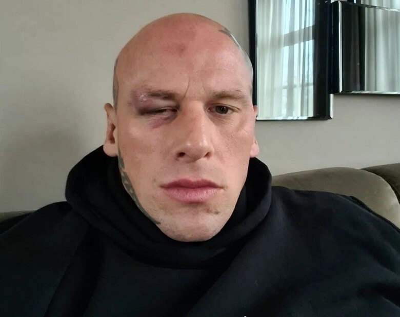 چشم غول انگلیسی قبل از مبارزه با هالک ایرانی کبود شد.