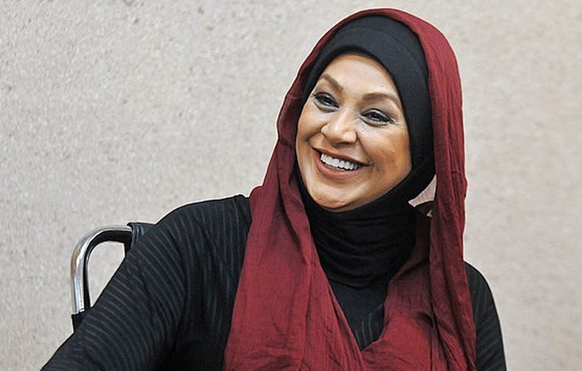 چهره شسته رفته "خانم بازیگر" آبرو برایش نگذاشت/ عکس