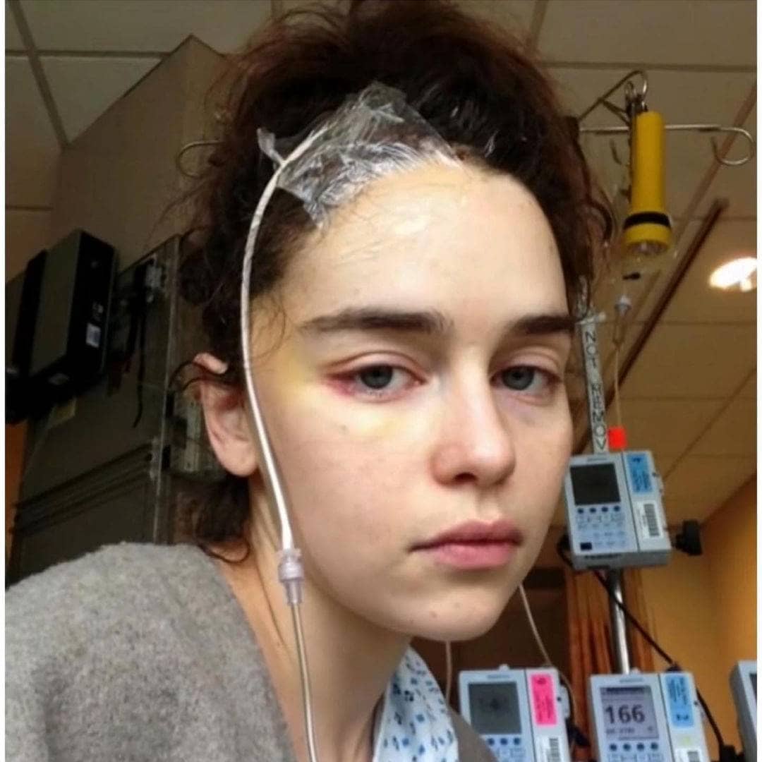 افشاگری امیلیا کلارک درباره بیماری مهلک‌اش