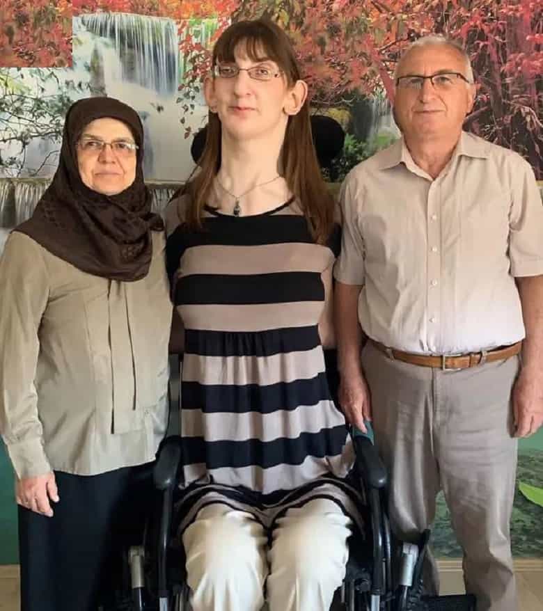 رومیسا گلگی بلندقدترین زن جهان است.