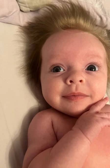 تصاویر/ موهای عجیب این نوزاد کل دنیا را حیرت زده کرد!