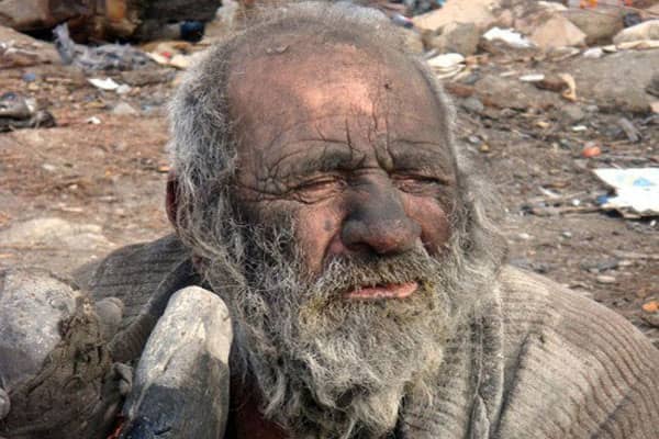 درگذشت مردی که از حمام و بهداشت گریزان بود