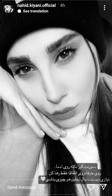 استوری جنجالی ناهید کیانی با تغییر چهره تازه اش