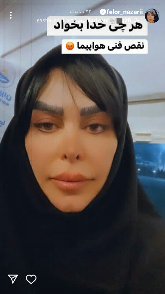 چهره جدید و باورنکردنی فلور نظری همه را شوکه کرد!