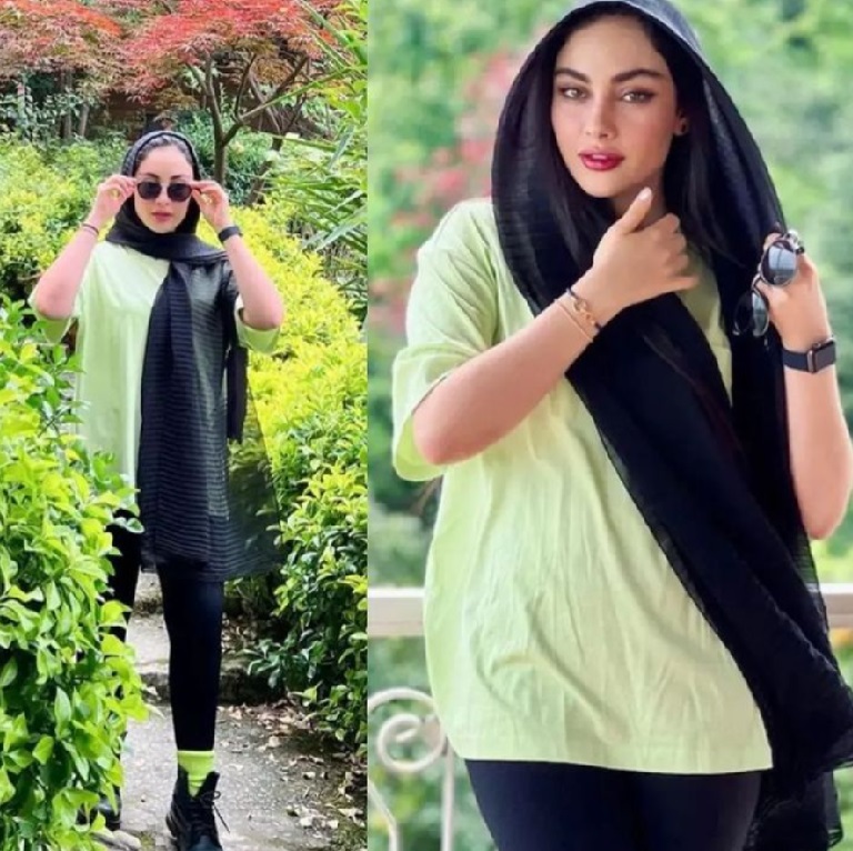 چاقی عجیب "ترلان پروانه" سوژه شد/ عکس چاقی عجیب "ترلان پروانه" سوژه شد/ عکس