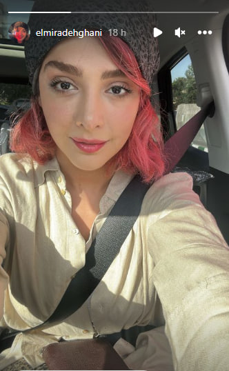 “خانم بازیگر تازه عروس” چهره اش را به کلی عوض کرد/ عکس