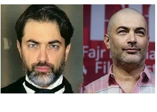 زیبایی “پارسا پیروزفر” بدون مو صد چندان شد/ عکس