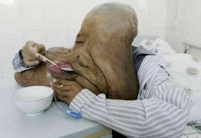 اگر دلش را ندارید نبینید،چهره ترسناک زشت ترین مرد جهان/ عکس