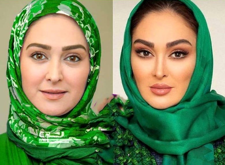 تصاویر/ الهام حمیدی چه بود و چه شد؛ باورنکردنی است!