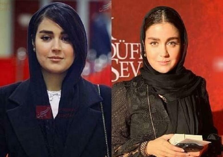 افشانه پاکرو عمل زیبایی نکرده است.