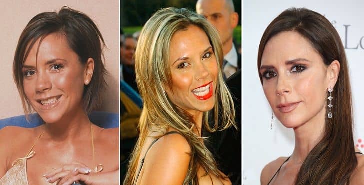 قبل و بعد عمل زیبایی ویکتوریا بکهام