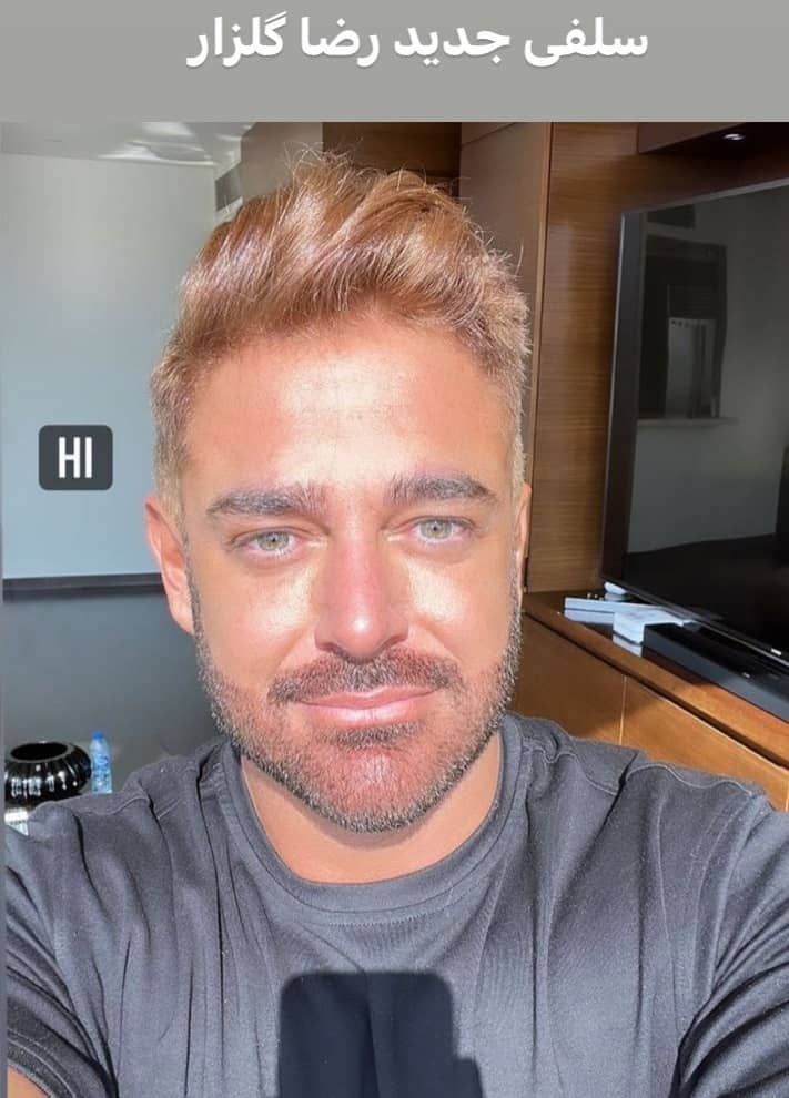 برنزه کردن محمدرضا گلزار را ببینید.