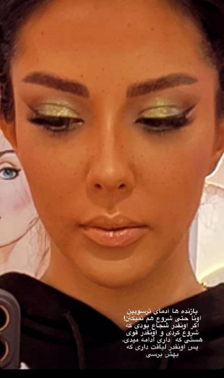 لیلا اوتادی چهره سوخته و برنزه دارد.